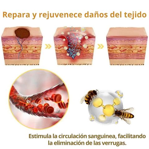 Dermabee