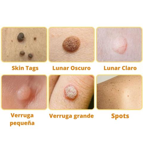 Dermabee
